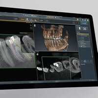 des radiographies dentaires numériques pour le bon diagnostic avec moins de radiations