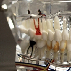 root canal treatment: treat a tooth whose pulp is compromised in order to keep it
